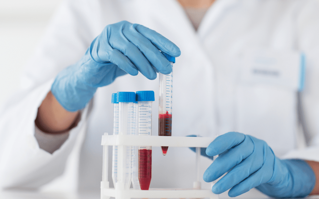 Skip the Lab: The Benefits of Mobile Phlebotomy