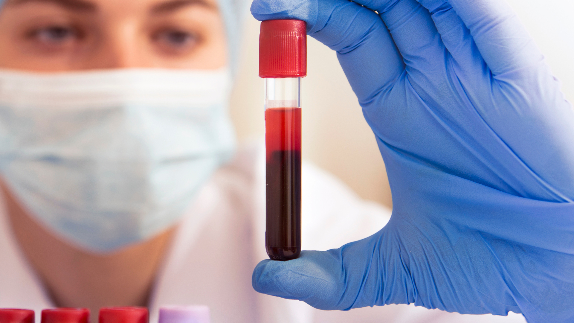 img-mobile-phlebotomy-athome (1)