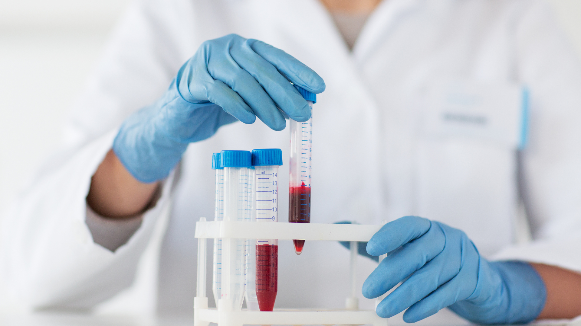 img-mobile-phlebotomy-athome (1)